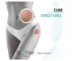 Soin Vergeture/ Tâche La Fontaine image